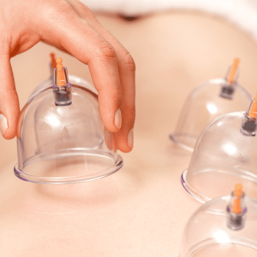massage therapy cupping
